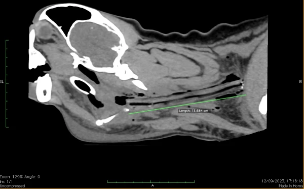 xray of dog with stick stuck in neck
